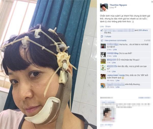 MC Thảo Vân phải nhập viện vì teo thùy não